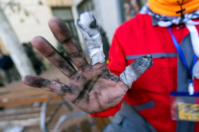 Hand of a Pyrotechnician
